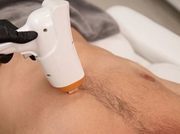 Laser Hair Reduction at Shri Aesthetics